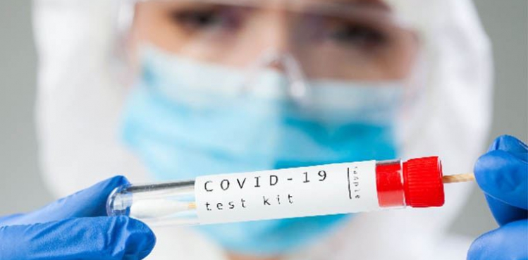 PCR testi ücretlerine zam
